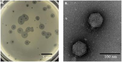 Characterization and genomic analysis of a lytic Stenotrophomonas maltophilia short-tailed phage A1432 revealed a new genus of the family Mesyanzhinovviridae